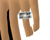 [i] Wedding ring