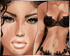 Vitiligo ~ Skin ~ T2