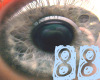 **Odd Eye** [88]