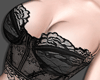 A| Lace corset