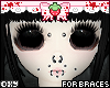 mine for braces 3
