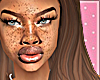 Freckles Head