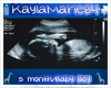 KaylaMarie84 Sonogram