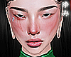 ゆみ Mine Bruised Head
