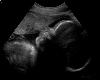 Ultrasound desktop pic
