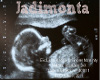 Ultrasound for Jadimonta