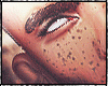 Custom Freckles II