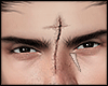 s. Scar Mesh Asri