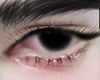 (B) Narrow Eyes !