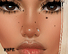 Scattered Face Moles