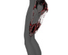 D+L+D
