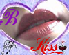 *B* KISS 