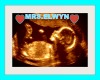 Mrs Elwyn  Baby Sonogram
