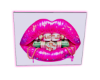 moeny lips