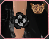 [ang]Glam Rose Brace