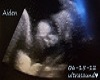 Aiden Ultrasound