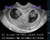 Massey twins ultrasound 