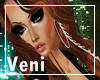 Kesha 6 |Ven