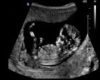 baby ultrasound 1