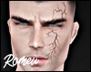Veins Scars MH