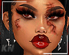 T2 | Bloody Skin 🩸
