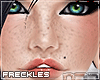 .n77 Freckles AnySkin