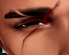 Amore Scar in my Face