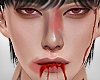 ✦ Bruise²