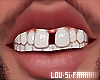  . M Teeth 134
