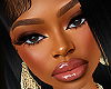 MH | Rare
