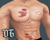 Kisses Scar Bite Muscule