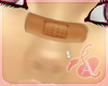 [A] Nose band aid