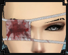 ◄R Bloody Eyepatch►