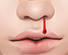Z* Anim. Bleeding Nose