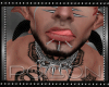 |P| Infected Lip Nails