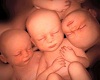 vanns triplets birth cer