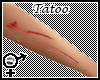 Tck_Left Arm Scar Tatoo