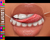 †. MH Teeth 03