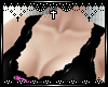 [Anry] Aby Pink Ohm
