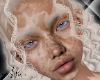 Il Dina Vitiligo NL v1