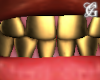 Asteri Gold Grillz
