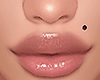 D| Mole Left Cheek