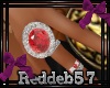 *RD* Ruby Right Rings