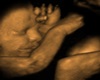 My Baby Ultrasound