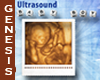 Baby Boy Ultrasound