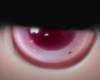 Eye Pink