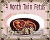 4 Month Twins In Tummy