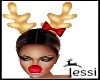 J~Rudolph Nose& Antlers