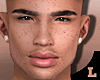 Lv- Head^..RDP Freckled