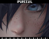 !! Freckles